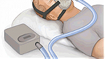 اجهزة طبية تنفسية - Image 1