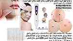 علاج الزوائد الجلدية التخلص من النمش عن الوجه وزوائد اللحمية الشامات - Image 1