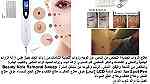 علاج الزوائد الجلدية التخلص من النمش عن الوجه وزوائد اللحمية الشامات - Image 4