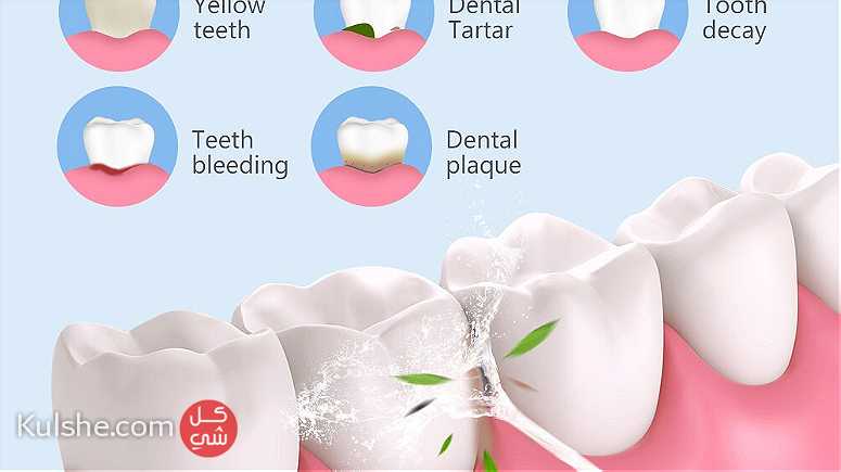 أنواع جهاز تنظيف الاسنان وفوائده ماذا تعرف عن جهاز تنظيف الأسنان - Image 1