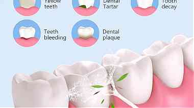 أنواع جهاز تنظيف الاسنان وفوائده ماذا تعرف عن جهاز تنظيف الأسنان