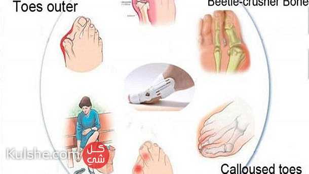 علاج اعوجاج إبهام القدم مشد طبي القدم علاج اصبع القدم - Image 1