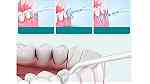 العناية بالاسنان اجهزة تنظيف اسنانك بديل الخيط فوائد مضخة تنظيف الاسنا - صورة 11
