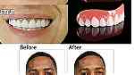 طقم اسنان مؤقت perfect smile ابتسامة هوليود مع منتج بيرفكت سمايل اسنان - Image 1