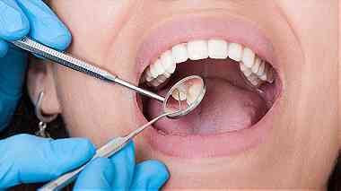 علاجات اسنان مجانية