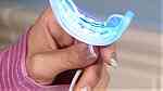 ابتسامة بيضاء طرق منزلية لتبيض الأسنان الصفراء - طريقة تبييض الاسنان - Image 5